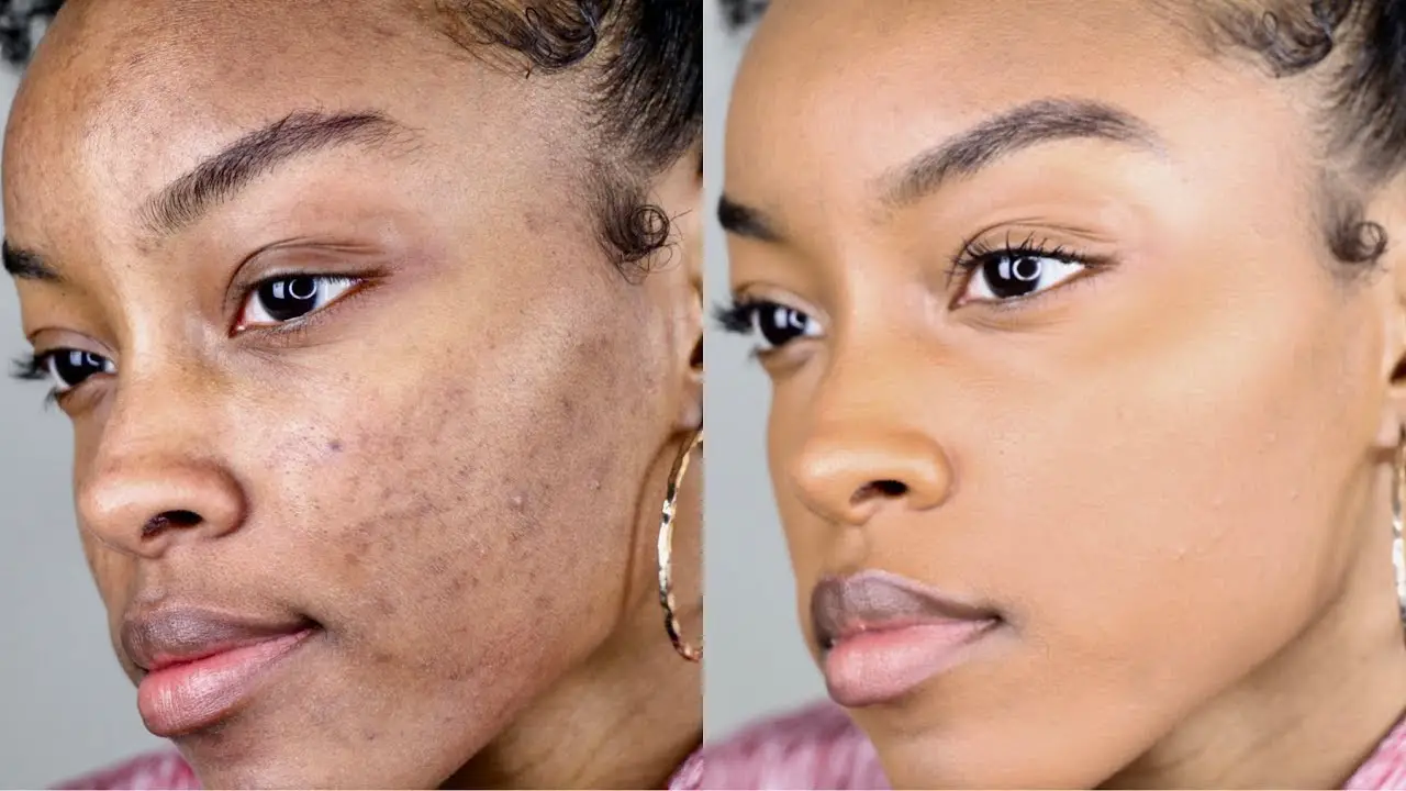 How To Hide Dark Spots On Your Face Without Makeup