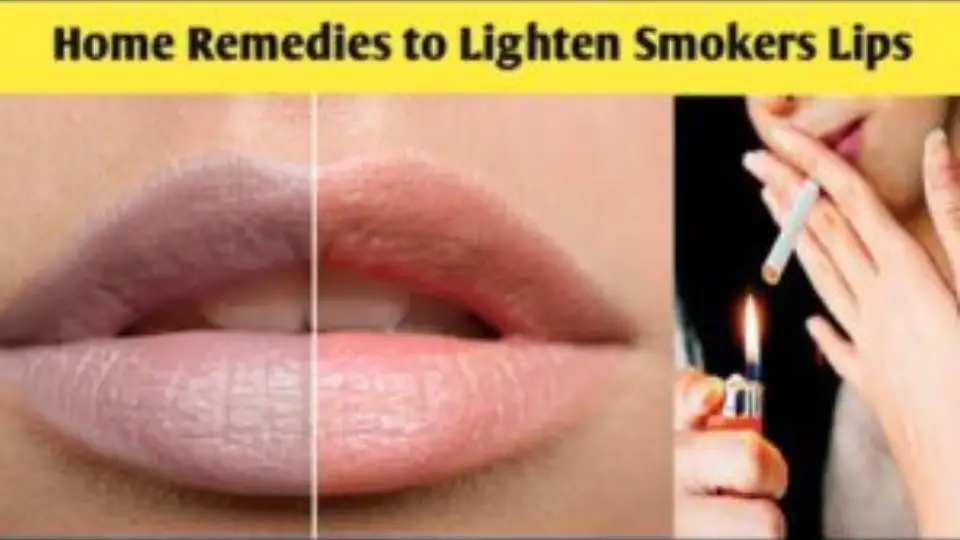 Home Remedies for Smokers Lips