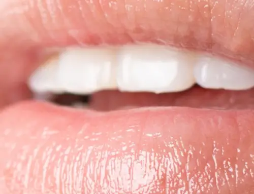 How to Moisturize Lips Without Lip Balm